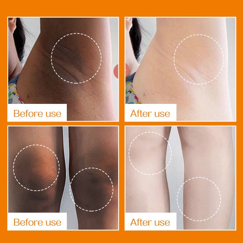 Vitamin C Whitening Cream